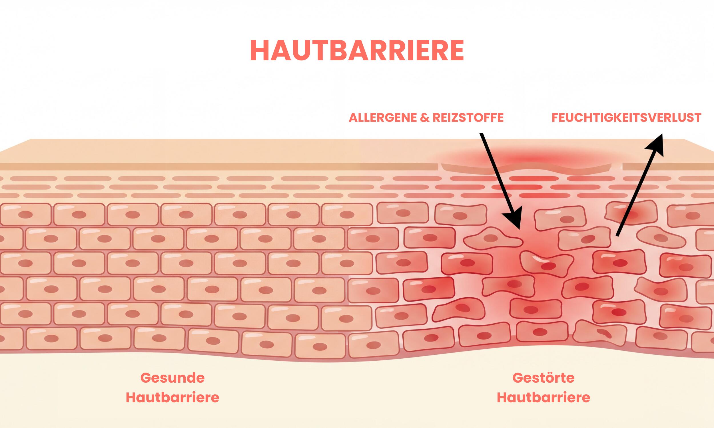 Die Infografik zeigt den Vergleich zwischen einer gesunden und einer geschädigten Hautbarriere, wobei bei der geschädigten Haut Feuchtigkeit verloren geht und Allergene sowie Reizstoffe leichter eindringen können.